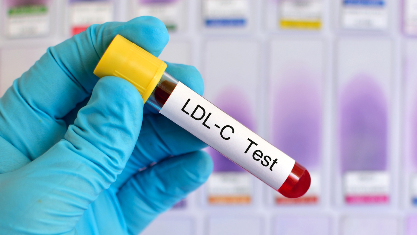 Service for Testing the Efficiency of LDL Cholesterol Production