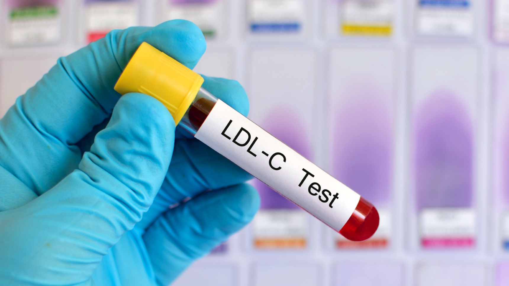 บริการทดสอบประสิทธิภาพการผลิตคอเลสเตอรอล ประเภท LDL ในผลิตภัณฑ์