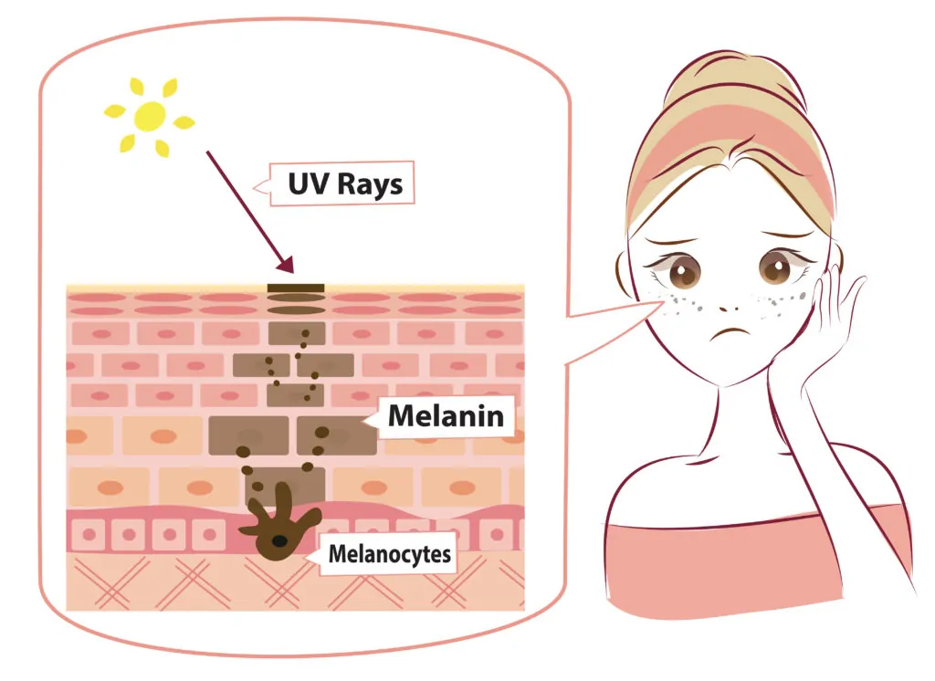 Anti-melanogenesis