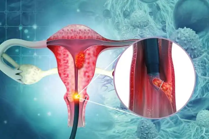 Anti-Cervical Cancer