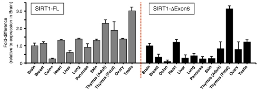 ตัวอย่างรายงานผลวิเคราะห์การแสดงออกของ Sirtuin gene ด้วยเทคนิค PCR