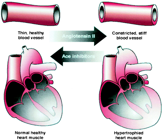 รูป แสดงผลกระทบของสารยับยั้ง angiotensin II และ ACE1 ต่อระบบหัวใจและหลอดเลือด