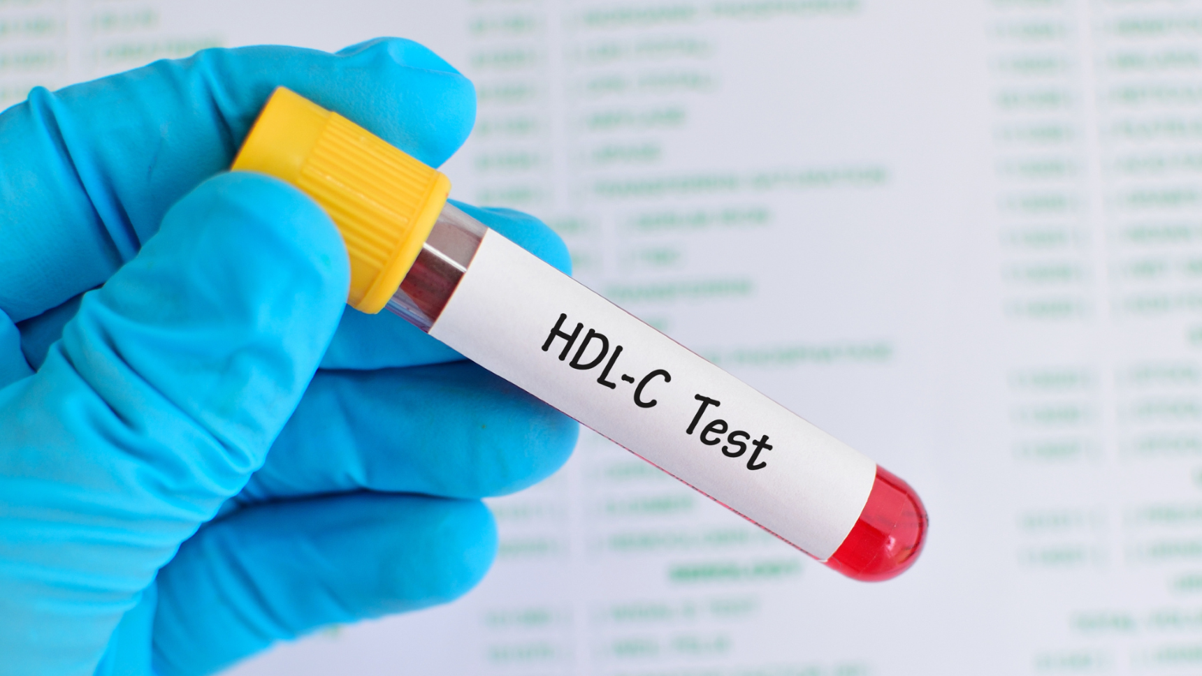 Service testing on the efficiency of High-Density Lipoprotein (HDL) cholesterol production