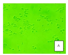 Toxicity in cell