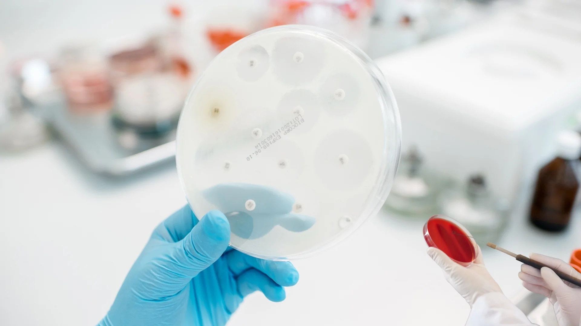 บริการทดสอบการปนเปื้อน ฤทธิ์ยับยั้งเชื้อ Anti-Microbial Anti-Bacterial