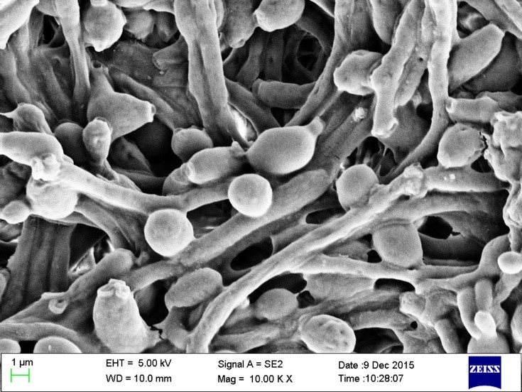 Anti-Microbial Anti-Bacterial