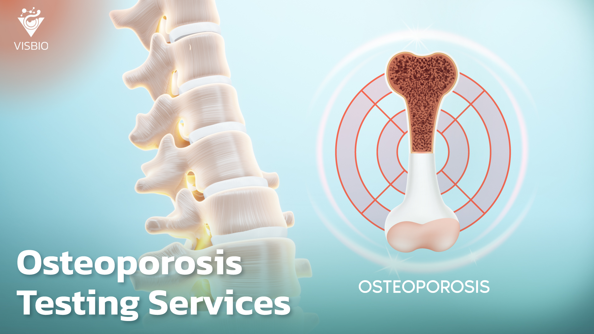 บริการทดสอบเกี่ยวกับภาวะกระดูกพรุน Osteoporosis