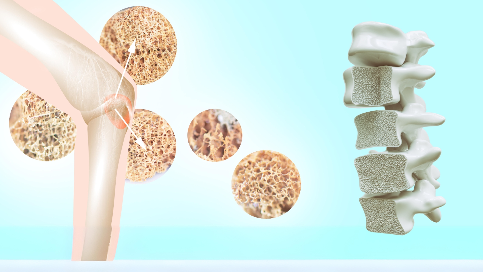 Osteoporosis Testing Services (Osteoporosis work)