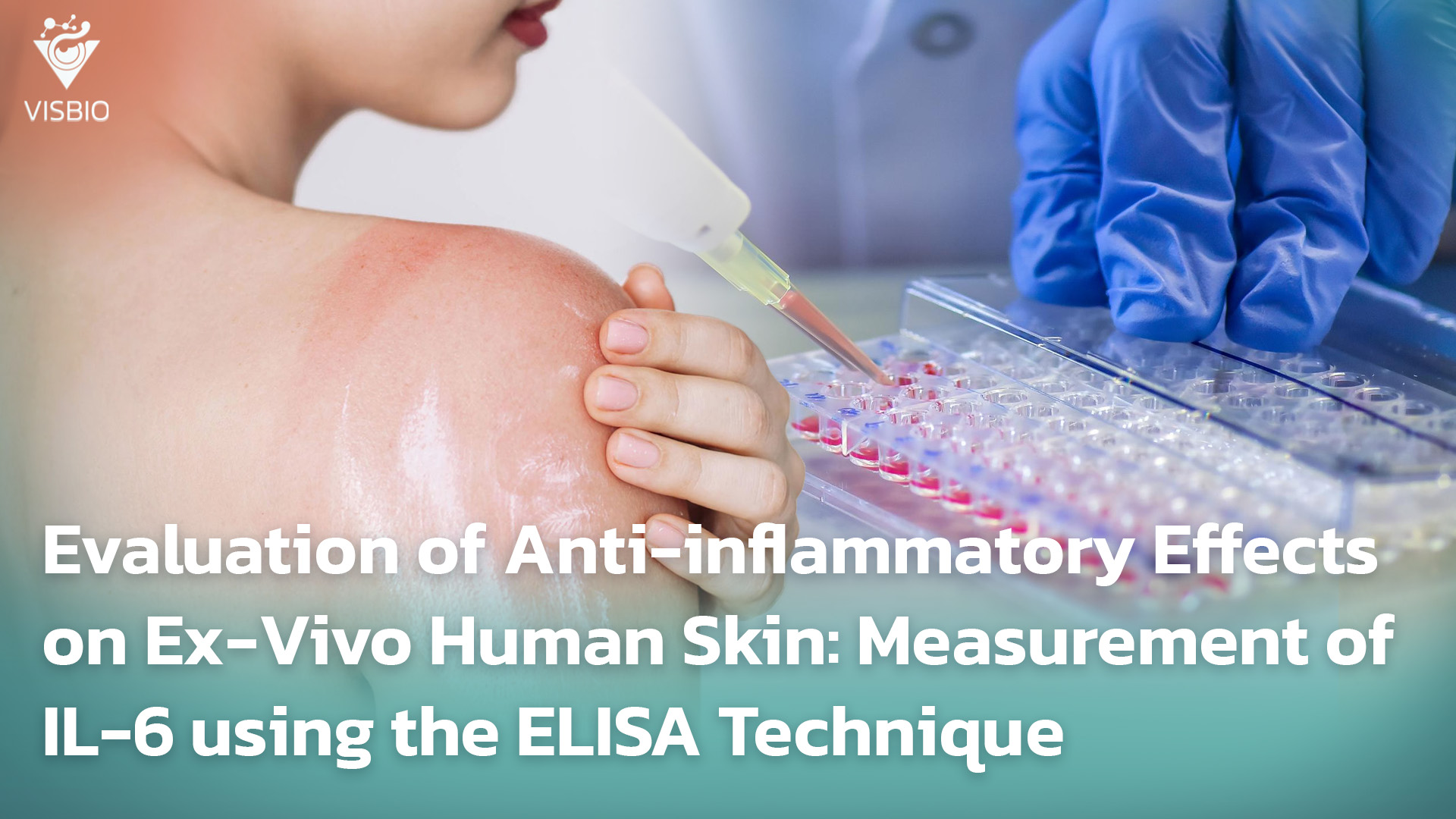 การประเมินฤทธิ์ต้านการอักเสบบนผิวหนังมนุษย์ Ex-Vivo: การวัด Interleukin-6 (IL-6) ด้วยเทคนิค ELISA