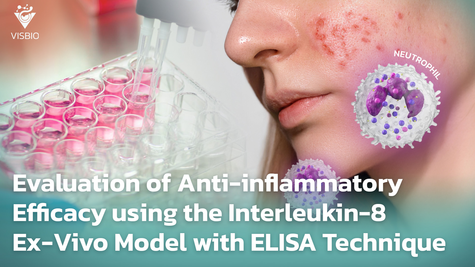 การประเมินประสิทธิภาพการต้านการอักเสบ Interleukin-8 แบบจำลอง Ex-Vivo ด้วยเทคนิค ELISA