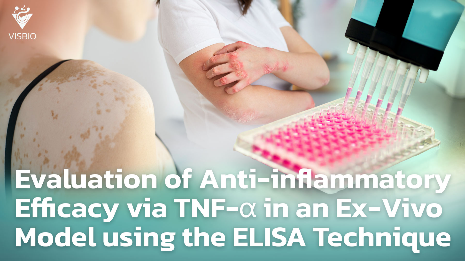 การประเมินประสิทธิภาพการต้านการอักเสบ TNF-α แบบจำลอง Ex-Vivo ด้วยเทคนิค ELISA