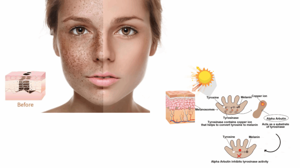 Skin whitening