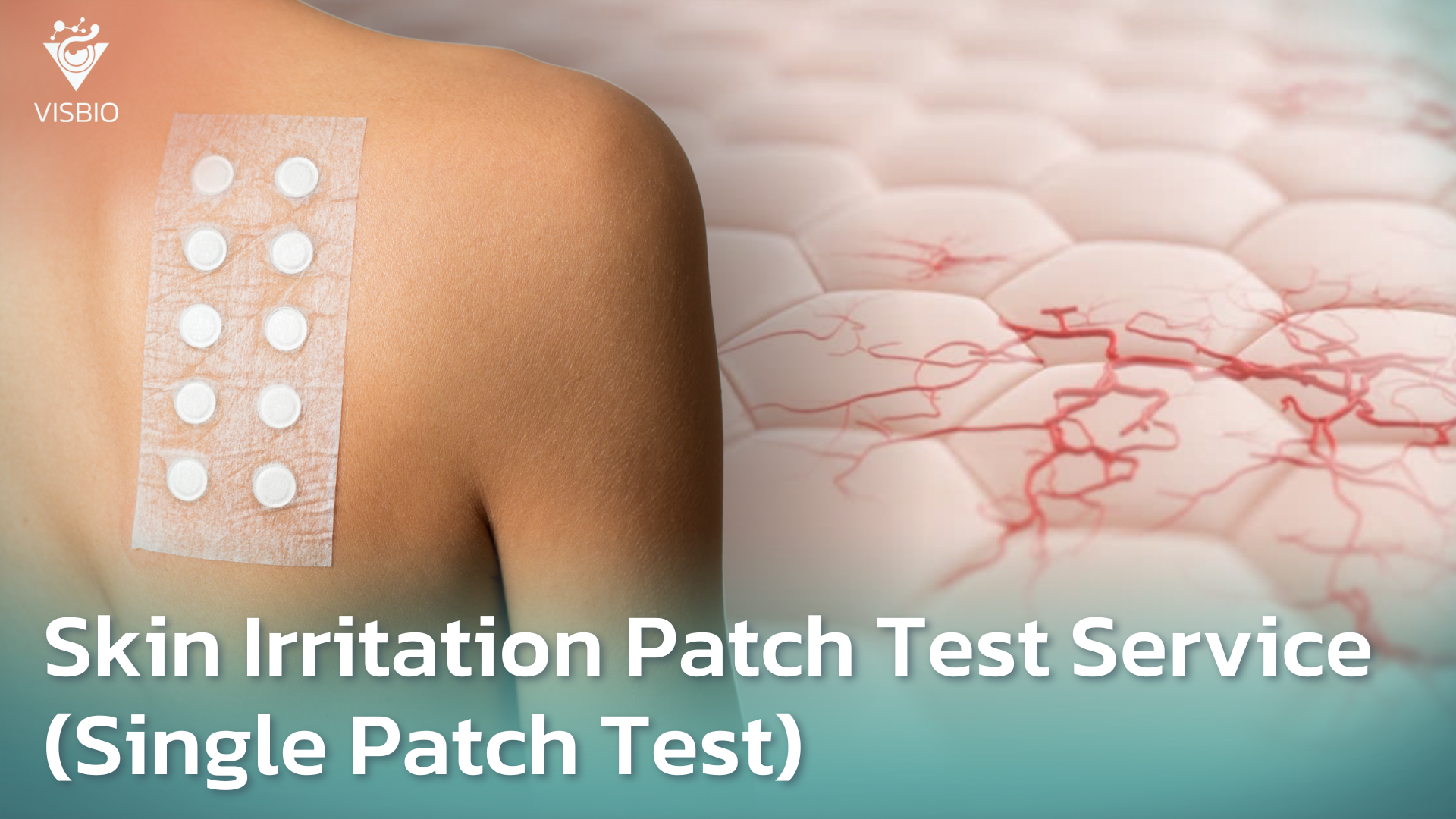 Clinical Evaluation Services: Single Patch Test for Skin Irritation